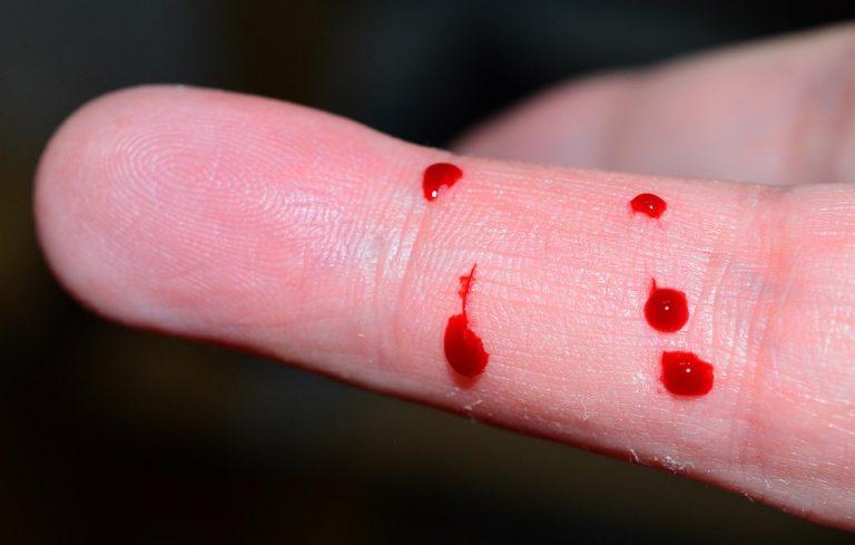 7 Simple Foods to Lower Blood Sugar Naturally Today